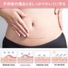 傷跡ケアテープ ケロイド テープ 傷あとケア用シリコンジェルシート 手術後 帝王切開 傷テープ 傷隠しテープ