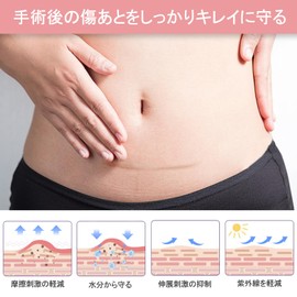 傷跡ケアテープ ケロイド テープ 傷あとケア用シリコンジェルシート 手術後 帝王切開 傷テープ 傷隠しテープ