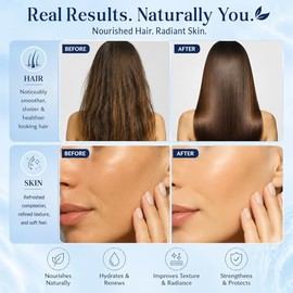 Nexon Botanics Aceite De Rosa Mosqueta Para El Rostro, 8 Onzas Líquidas - Aceite De Semilla De Rosa Mosqueta Para Gua Sha, Masajes Y Cuidado De La Pie