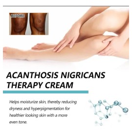 Crema Correctora Manchas Oscuras Hiperpigmentación, Vingtank