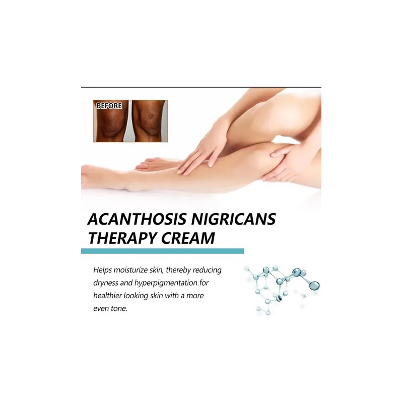 Crema Correctora Manchas Oscuras Hiperpigmentación, Vingtank