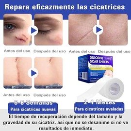 Parches de silicona para cicatrices, cinta para cicatrices de 3 metros, promueven la cicatrización de heridas, adecuados para reparar y eliminar cicat