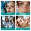 MedEduQuest Transparent Facial Injection Lip Model, Facial Model for Injection