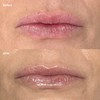 Cinch Minty Glow Lip Balm 15g