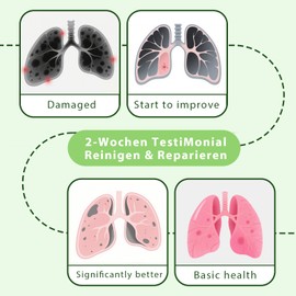 Lungenreinigung, 60 Pcs Atemwegs Pflege Pflaster, Advanced Lunge Detoxification Pflaster, NatüRlich Kräuter-Lungenreinigung Pflaste, Einfach Aufzutragen, für Eine Gesunde Lunge