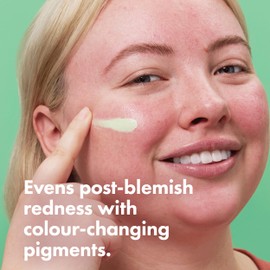 Rescue Balm Colour-Correcting Green Cream from Hero Mighty Patch, Red correct and soothes dry skin with long lasting hydration, Dermatologist Tested and suitable for sensitive skin, 15ml (Pack of 1)