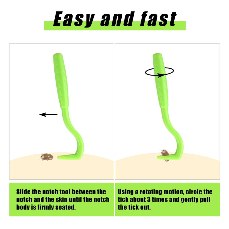 BOXOB 3pcs Tick Remover Tool Kit, 3 Sizes Green Plastic