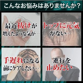 Keratin 7,500 mg Saw Palm 2,250 mg Zinc Supplement Black Up Energy 90 Tablets 30 Day Supply