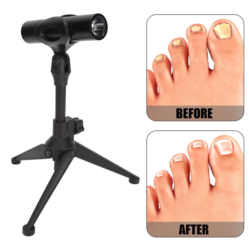 Nail Laser Treatment Pen Portable Pain Free Lightweight Whitening Physical