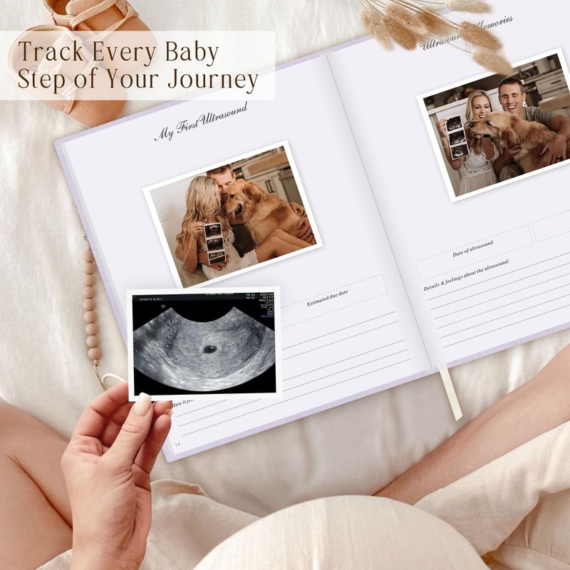 Lanpn My Pregnancy Journal Memory Book for First Time Mom,