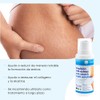 Stretch Mark Cream, 200 ml | Anti-Stretch Marks Body Cream,