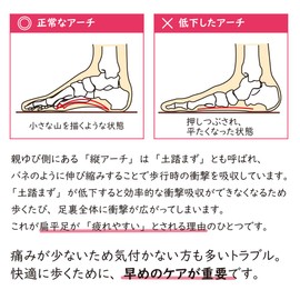 Foot Care Goods.COM Healthy Insole for Flat Feet with an "Inner Vertical Arch Pad" on the arch to support the arch to relieve pain and fatigue (Women's S (8.7 - 8.9 inches (22.0 - 22.5 cm))