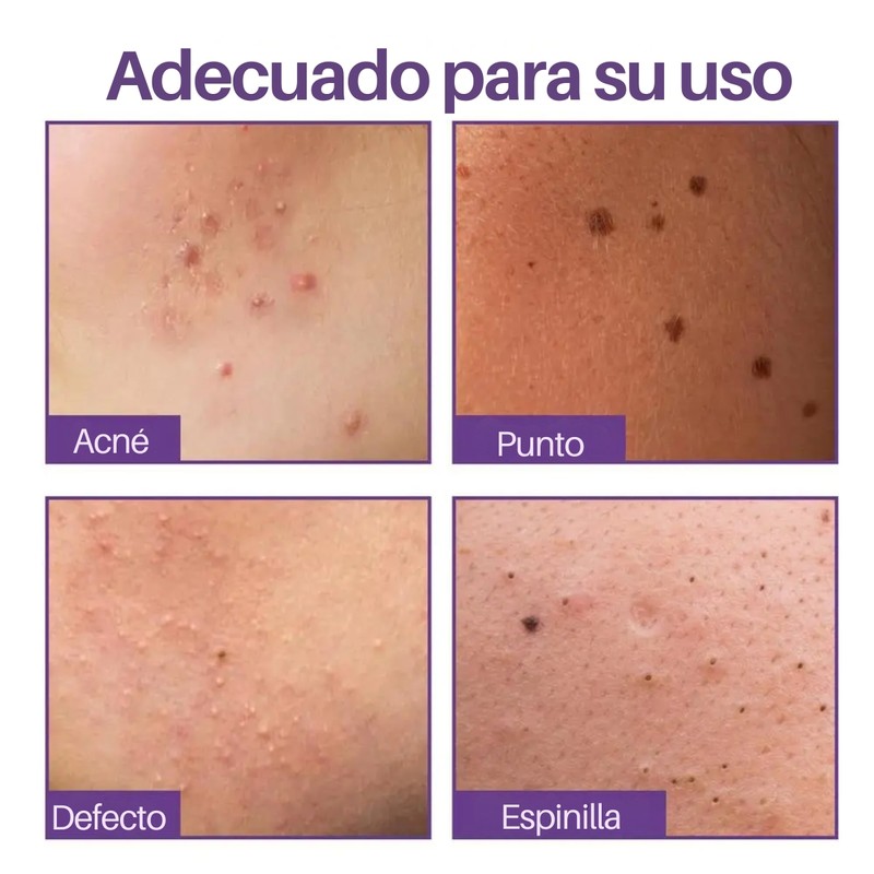 Parches Cubre Acné Estrellas