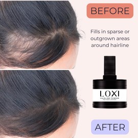 LOXI Hairline Powder - Root Touch Up & Hair Loss Cover Up, Instant Gray Coverage. Wind & Sweat Resistant. Powder for Women & Men (Black, 0.14oz)