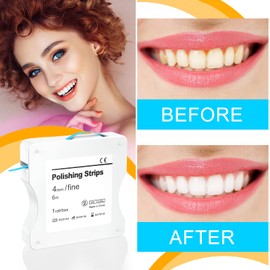AISEELY Dental Polishing Strips, 1Pc Whitening Strip, 4mm Tooth Sandpaper Thickness Teeth Resin Tooth Interdental Grinding Tool, 6m/Rolls/Box (Blue-Fine)