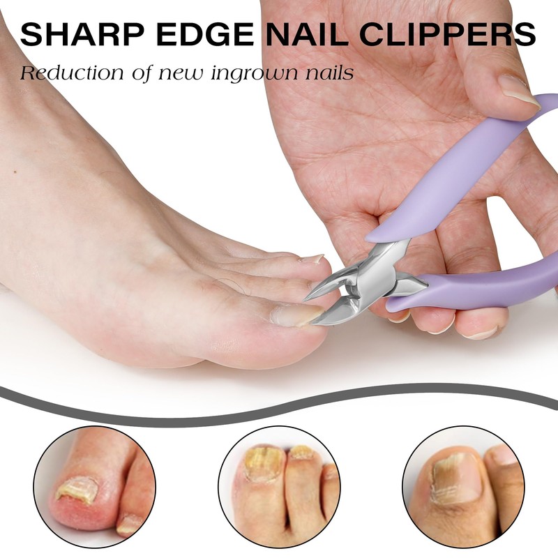 Professional Ingrown Toenail Clipper - Wide Jaw Toenail Cutter for