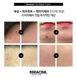 Lyricin Lilacin Cicari Repair Cream Soothing + Barrier 80g Lilacin Dew Sun Serum / 리라신 시카리페어크림 진정+장벽80g 리라신 듀 선세럼