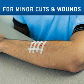 Care Science Adhesive Wound Closure Strips, 1/4 x 4 in, 30ct | Sterile Strips Used for Closing Minor cuts & Wounds