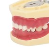 Periodontal Disease Teeth Resin Model Dental Demonstration Teeth Model for