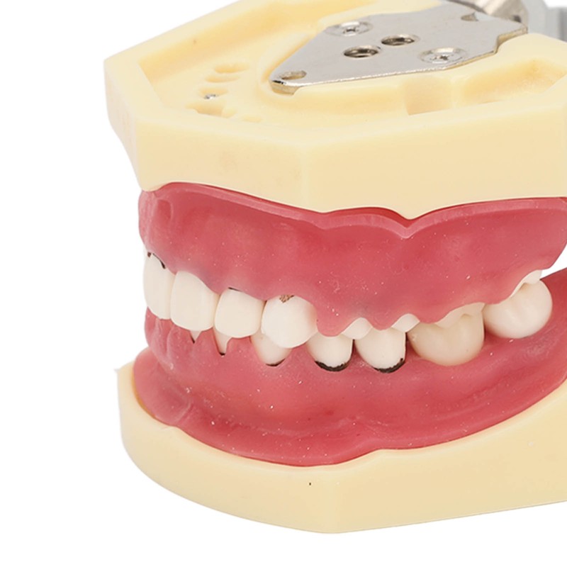 Periodontal Disease Teeth Resin Model Dental Demonstration Teeth Model for