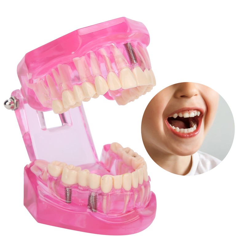 Transparent Adult Teeth Model Pathological Repair Studying Dental Teaching Tools