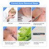 4PCS Blackhead Remover Tool Set Acne Extractor Comedone Pimples Spot