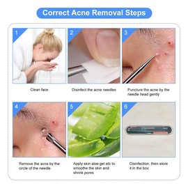 4PCS Blackhead Remover Tool Set Acne Extractor Comedone Pimples Spot and Zit