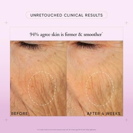 Ultimate Miracle Worker by Philosophy for Unisex - 0.5 oz Cream | This high-performance, unisex anti-aging cream targets multiple signs of aging by pr