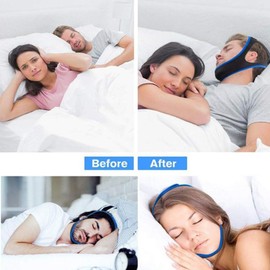 Veralabs Airflow Jaw Strap, Air Flow Jaw Strap, Airflow Jaw Strap Veralabs, Breathable Snoring Chin Strap, Anti Snoring Chin Strap, Airflow Jaw Strap for Sleep Apnea Veralabs (Blue + Black)