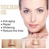 Turmeric Serum, Dark Spot Correcting Serum, Hyperpigmentation Treatment, Dark Spot