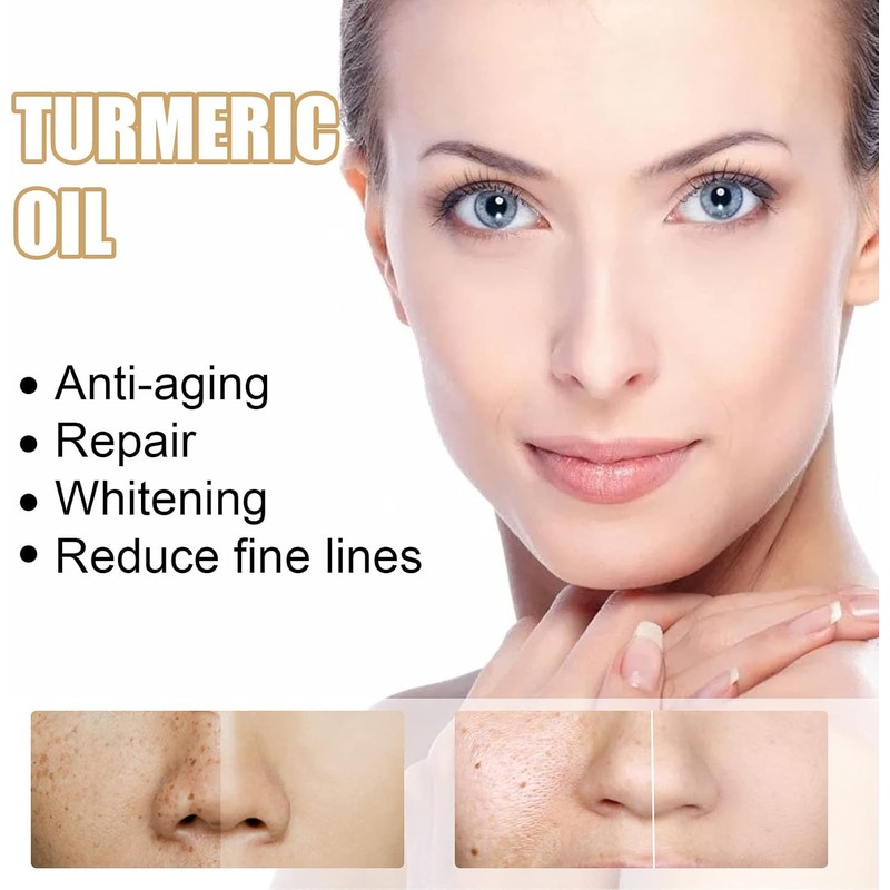 Turmeric Serum, Dark Spot Correcting Serum, Hyperpigmentation Treatment, Dark Spot