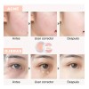 * Corrector E Iluminador De Ojos En Crema Alta Cobertura
