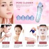 4 Replaceable Heads Blackhead Vacuum Removal Pore Acne Suction Cleanser