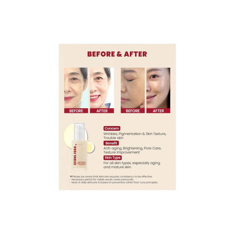 KSECRET [KSECRET]SEOUL 1988 Serum Retinal Liposome 2% + Black Ginseng