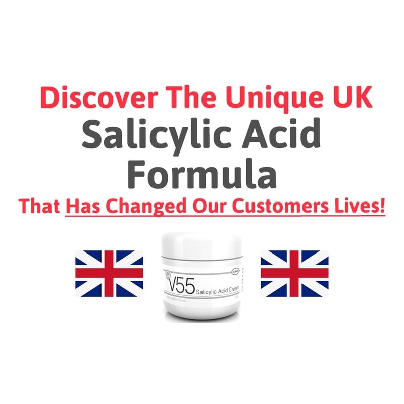 V55 Salicylic Acid Cream for Spots Blackheads Blemishes and Problem