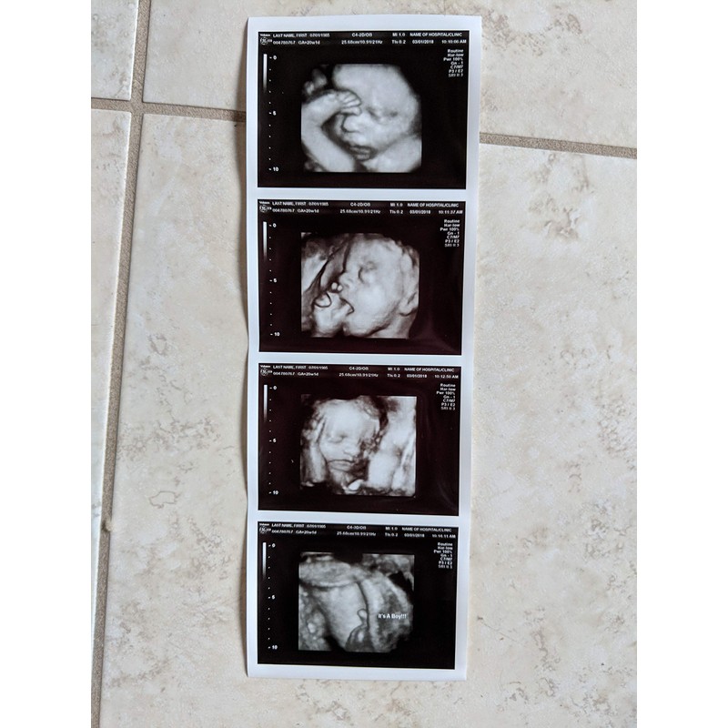 Prank 3D Customized Fake Ultrasound Strip of 4 Photos
