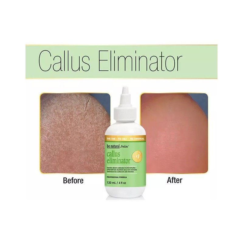 BCL Spa Eliminador De Callos Pedicure Uso Profesional Spa 29