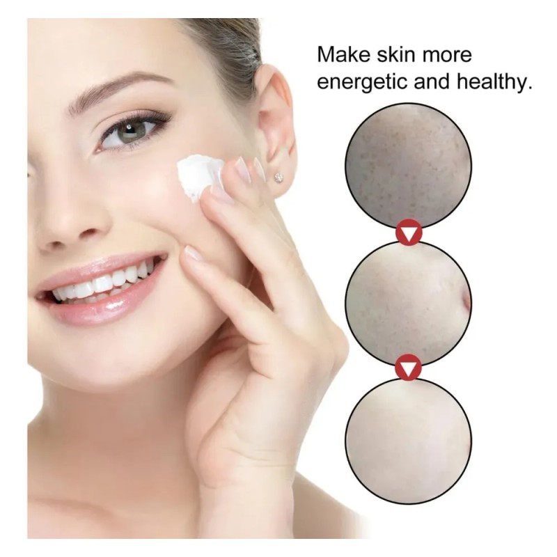 Crema Facial Despigmentante Y Anti Manchas Pack 2 Pzs Todo