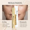 Lamelin B-Tox Serum