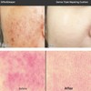 DIFFER&DEEPER Derma Triple Reparing Cushion SPF50+ PA+++ 15g