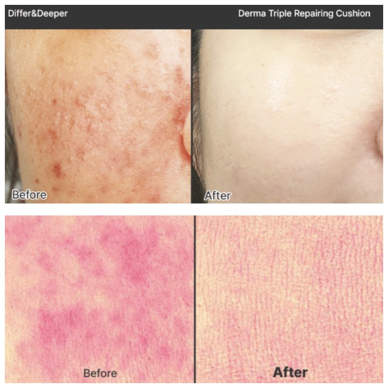 DIFFER&DEEPER Derma Triple Reparing Cushion SPF50+ PA+++ 15g