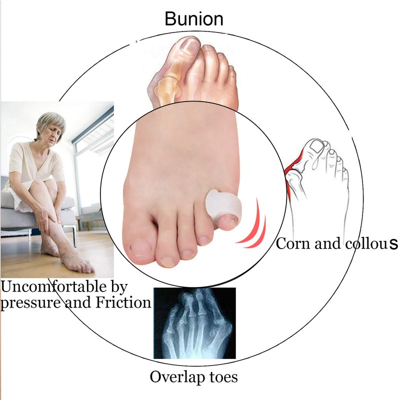Yimanduo 10 Pcs Pinky Toe Splint, Gel Toe Separators, Little