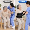 Transfer Assist Sling with Handles for Caregiver-Assisted Bed and Chair
