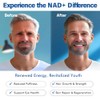 NAD+ Supplement 1500MG, 120PCS Ultra NAD+ & Resveratrol Supplement