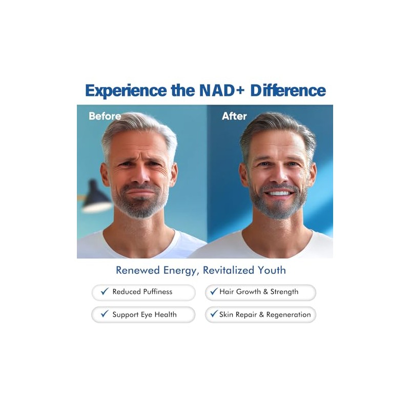 NAD+ Supplement 1500MG, 120PCS Ultra NAD+ & Resveratrol Supplement