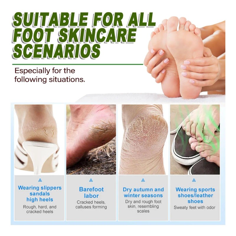 Crema Hidratante Para Pies Resecos Y Agrietados Moisturizing