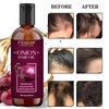 Generic Onion Hair Oil for Hair Growth and Hair Fall