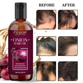 Generic Onion Hair Oil for Hair Growth and Hair Fall Control, Cold-Pressed Onion Black Seed Oil Extracts (100 ML)