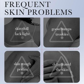 Kojic Acid Skin Whitening Body Lotion, Skin Whitening Body Lotion with Kojic Acid, Brightening Body Cream for Radiant Skin, Moisturising and Quick-Absorbing Body Cream Body Lotion