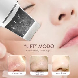 Bitina -limpiador Facial Ultrasnico Limpieza Eliminacin Espinillas                                                                                    